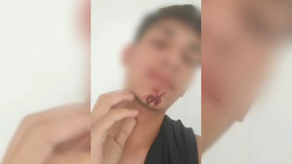 Fiscal é demitido após agredir adolescente vendedor de morangos em BC