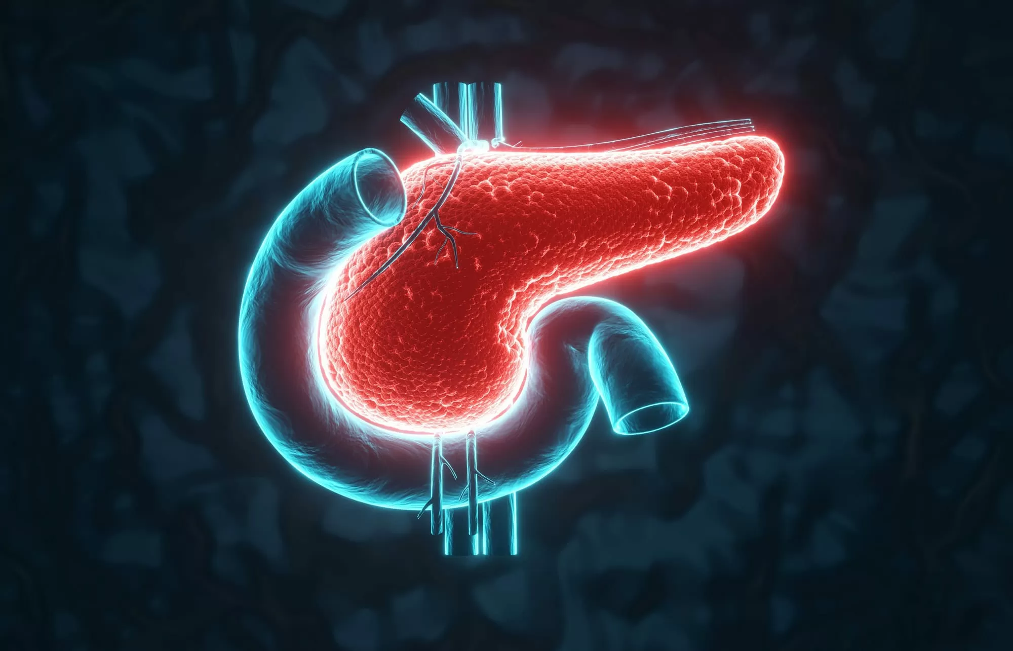 Combinação tripla elimina câncer de pâncreas em testes