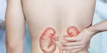 Los alimentos que debería evitar para cuidar sus riñones