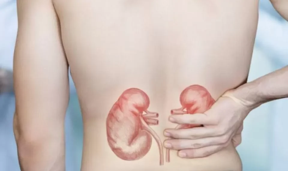 Los alimentos que debería evitar para cuidar sus riñones