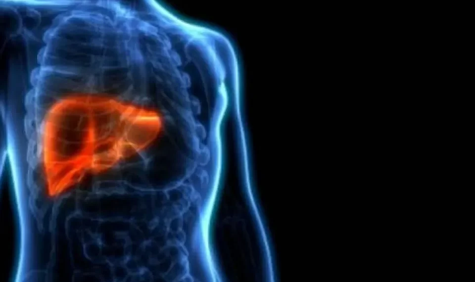 ¿Cuál es el tratamiento idóneo para el hígado graso?