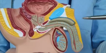 Lo dicen los expertos: ¿cómo me doy cuenta de que estoy mal de la próstata?