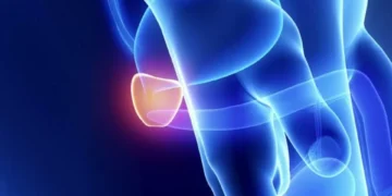 ¿Qué no debe hacer un hombre con la próstata inflamada?