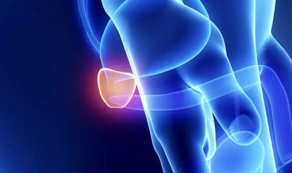 ¿Qué no debe hacer un hombre con la próstata inflamada?