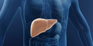 ¿Cuáles son las causas del hígado graso? Tenga cuidado