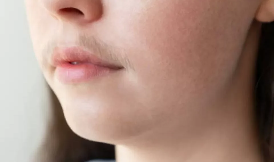 Bigote femenino, tendencia contra estándares de belleza: a qué se debe su popularidad