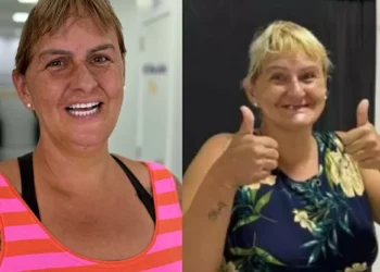 Fim do mistério! Conheça o novo sorriso de Mery ❤️