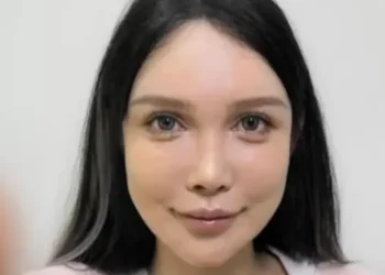 El ‘boom’ de la cirugía estética en China: mujer se ha operado más de 100 veces