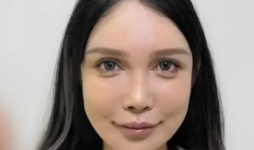 El ‘boom’ de la cirugía estética en China: mujer se ha operado más de 100 veces