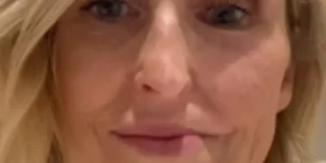 Médicos reconstruyen con partes de pierna y pie el paladar de mujer con cáncer de boca