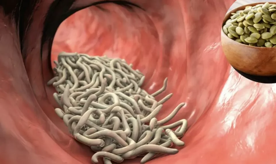 Dígale adiós a los parásitos intestinales: las 6 recetas caseras para limpiar su cuerpo