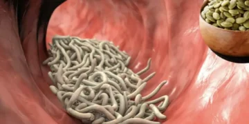 Dígale adiós a los parásitos intestinales: las 6 recetas caseras para limpiar su cuerpo