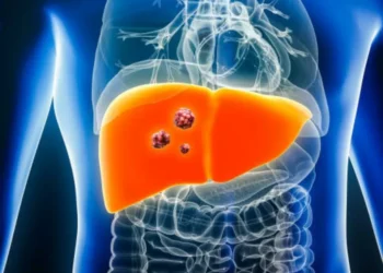 El examen que permite identificar el cáncer de hígado antes de que aparezcan síntomas
