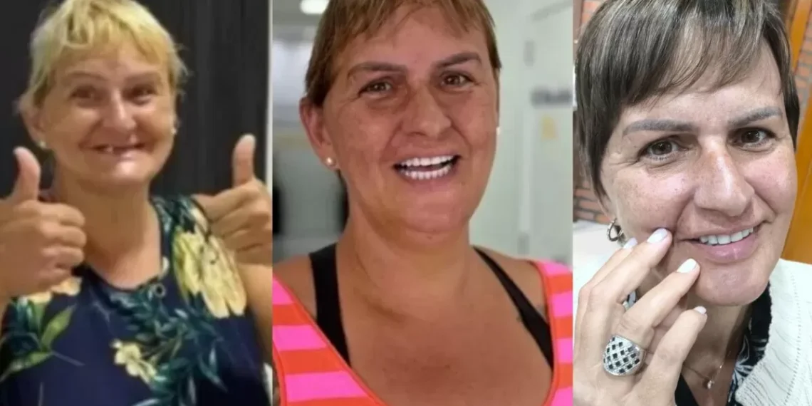 Renovada! Após conquistar novo sorriso, Mery recebe tratamento de beleza e se transforma em outra mulher