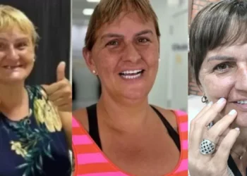 Renovada! Após conquistar novo sorriso, Mery recebe tratamento de beleza e se transforma em outra mulher