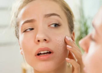 Piel escamosa y ojos resecos: la falta de esta vitamina puede arruinar su cuerpo