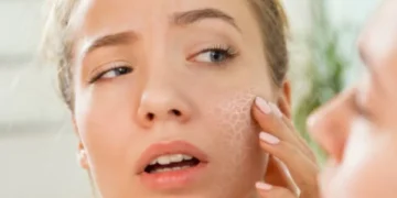 Piel escamosa y ojos resecos: la falta de esta vitamina puede arruinar su cuerpo