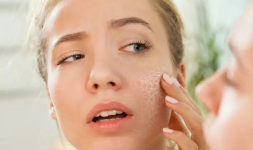 Piel escamosa y ojos resecos: la falta de esta vitamina puede arruinar su cuerpo