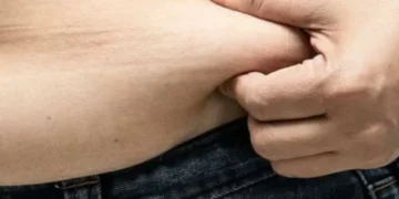 Según un endocrino, tener mucha barriga podría ser un indicador preocupante