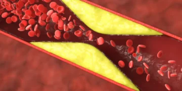 Esta es la bebida definitiva que puede ayudarle a reducir el colesterol