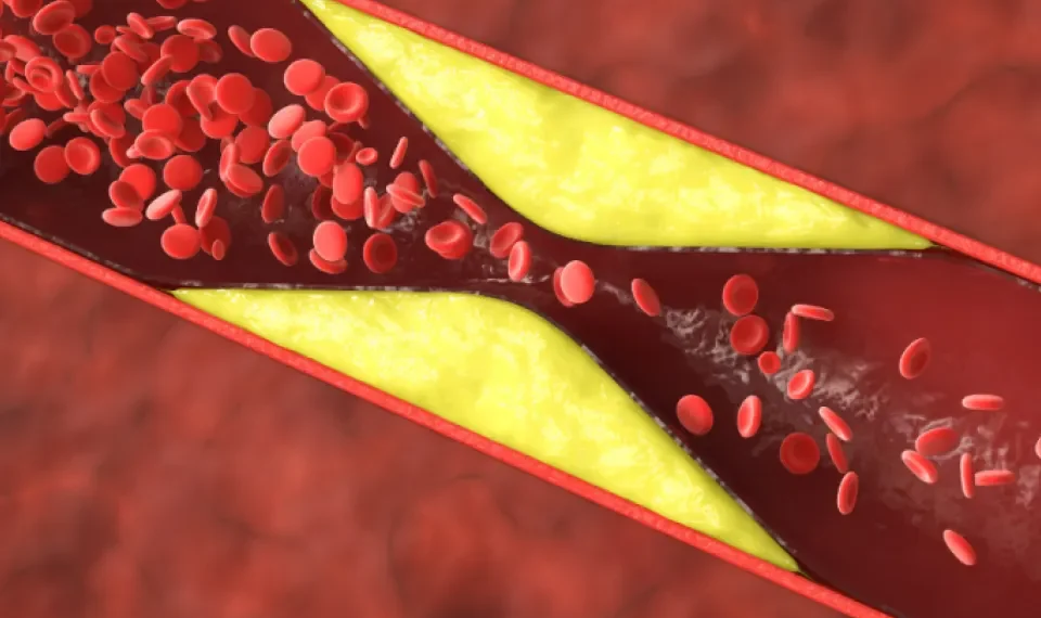 Esta es la bebida definitiva que puede ayudarle a reducir el colesterol