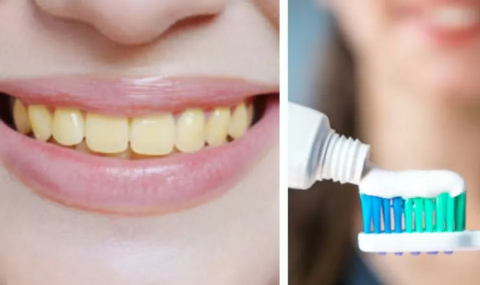 Ni agua ni productos raros: 5 maneras expertas de evitar que el café manche los dientes
