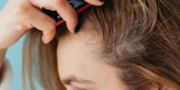 ‘No lo adquiera’: el producto ilegal para el crecimiento capilar que prohibió Invima