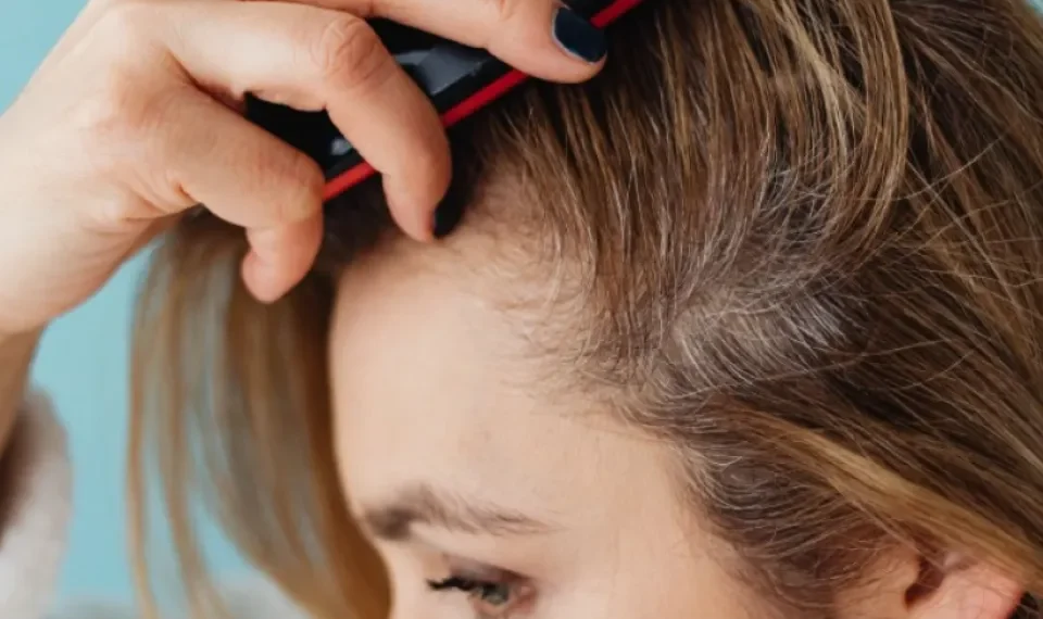 ‘No lo adquiera’: el producto ilegal para el crecimiento capilar que prohibió Invima