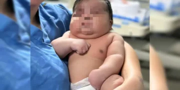 Parto normal de bebê de 6,5 kg vira alvo de investigação; mãe levou 55 pontos
