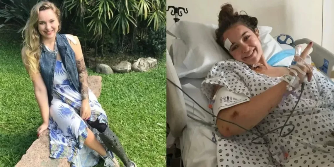 Brasileira que perdeu braço e perna após ser atropelada por metrô em NY vai receber R$ 435 milhões