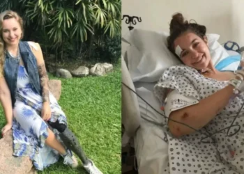 Brasileira que perdeu braço e perna após ser atropelada por metrô em NY vai receber R$ 435 milhões