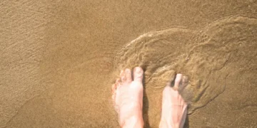 O que é o bicho geográfico? Entenda a condição de saúde, causas e tratamento