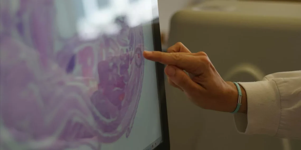 Oito associações de doentes pedem compromisso público com a oncologia