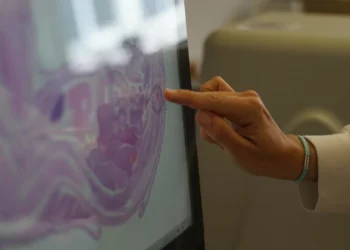 Oito associações de doentes pedem compromisso público com a oncologia