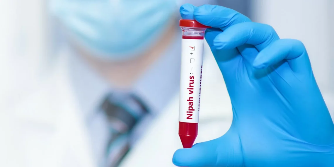 Entrevista: há risco de um surto do vírus Nipah?