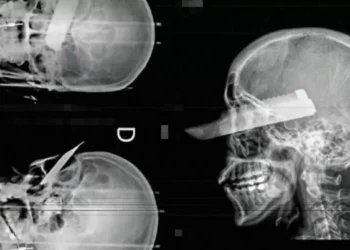 Homem enfia faca no olho da companheira e é encontrado dormindo na cena do crime em SC